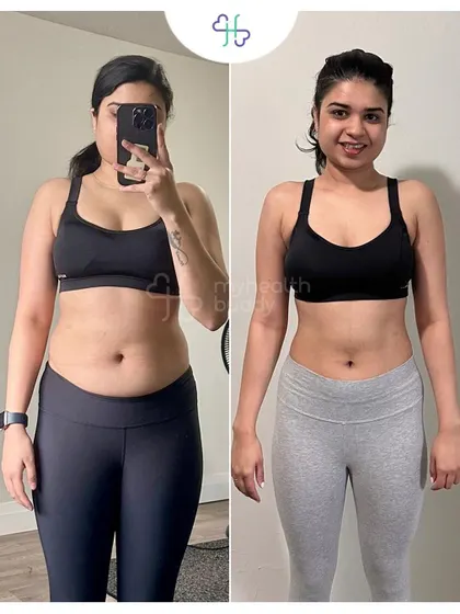 Front view of her journey from 56 kg to 51 kg. She looks incredibly toned and strong.