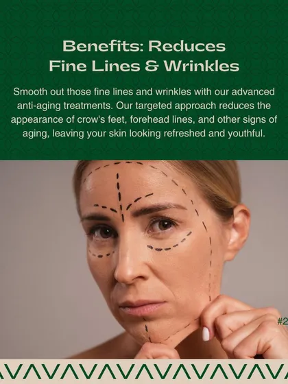 My targeted approach helps to smooth out fine lines and wrinkles. I focus on reducing the appearance of crow's feet and forehead lines for a refreshed and youthful look.