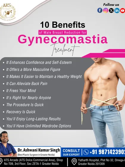 This graphic lists ten key benefits of gynecomastia treatment, including enhanced self-esteem, a more masculine figure, easier weight maintenance, and long-lasting results.
