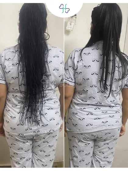 Back view of Vidhi's progress.