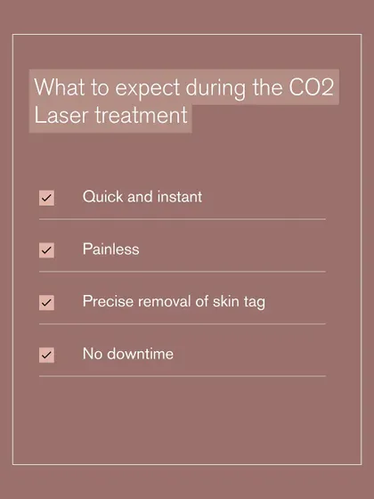 What can you expect during a CO2 laser treatment for skin tags? The procedure is quick, painless, precise, and involves no downtime, so you can get back to your routine immediately.