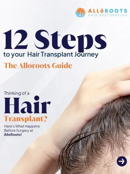 A hair transplant journey can feel overwhelming. I created this 12-step guide to provide a clear, transparent roadmap of what happens before, during, and after your surgery with me. You will be informed and empowered at every stage.