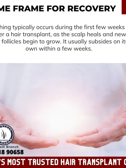 This graphic explains the recovery timeframe, noting that itching typically occurs in the first few weeks and subsides on its own as the scalp heals.