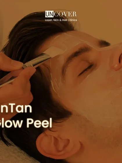 The UnTan Glow Peel is a perfect treatment to erase summer tans and reveal a flawless complexion just in time for the festive season.