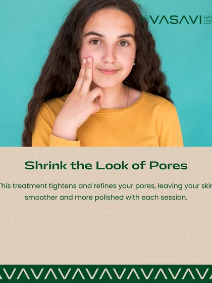 The Carbon Peel treatment also helps to shrink and refine the look of pores. With each session, your skin becomes smoother and more polished.