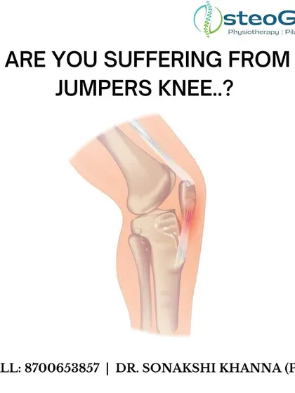 Jumper's Knee is an overuse injury of the patellar tendon, common in sports with a lot of jumping. Treatment involves rest, specific exercises, and physical therapy to strengthen the supporting muscles.