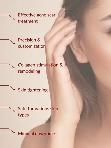 The benefits of Morpheus8 are extensive. It offers precise, customizable treatment for acne scars, skin tightening, and collagen stimulation with minimal downtime, making it safe for various skin types.