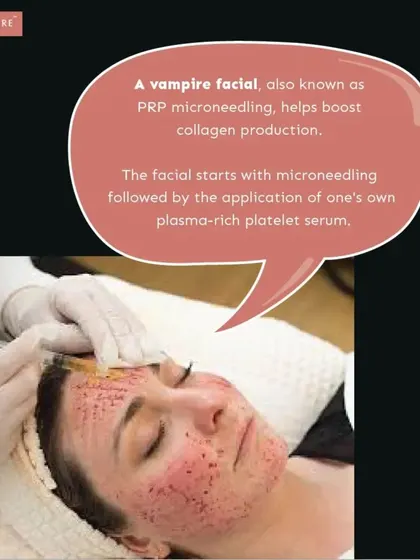 This image shows a Platelet-Rich Plasma (PRP) or 'Vampire Facial' in progress. This treatment uses your own plasma to stimulate collagen and repair skin, making it highly effective for reducing the appearance of acne scars.