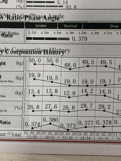 This chart tracks the progress of a 32-year-old patient who combined our Mounjaro program with Wonder Prestige body contouring. The results show a significant drop in body fat percentage and an increase in skeletal muscle mass, breaking through her previous weight loss plateau.