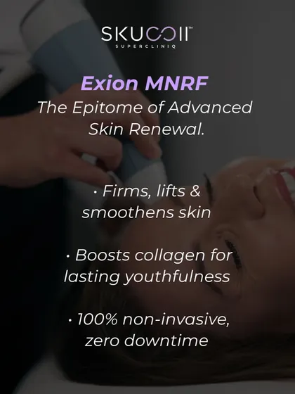 A closer look at the benefits of Exion MNRF, the epitome of advanced skin renewal. This non-invasive, zero-downtime treatment firms, lifts, and smoothens skin by boosting collagen, delivering lasting youthfulness.