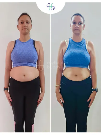 Front view of her 6-month journey. Her progress is a result of customized workouts and a nutrition plan tailored to her needs.