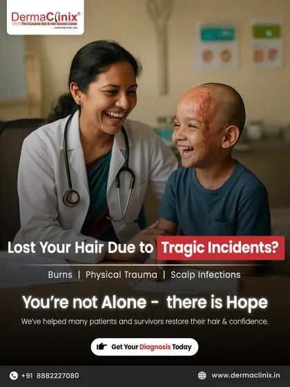 Hair loss can occur due to tragic incidents like burns, physical trauma, or scalp infections. We have helped many survivors restore their hair and confidence through specialized scar concealment and hair restoration procedures.