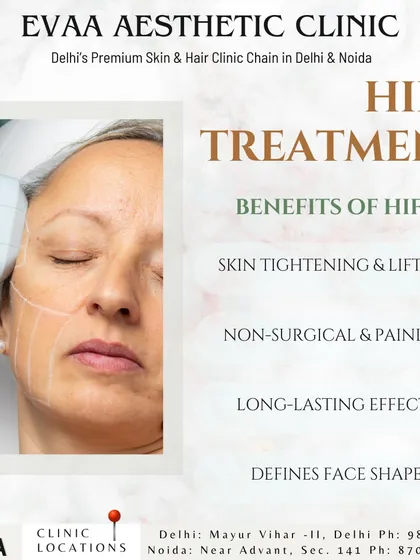 This graphic highlights the key benefits of HIFU treatment, emphasizing its ability to tighten and lift skin, its non-surgical and painless nature, its long-lasting effects, and its power to define facial shape.