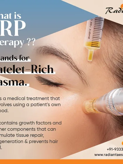 Many people ask me, what exactly is PRP therapy? It stands for Platelet-Rich Plasma. In simple terms, it's a medical treatment where I use your own blood. We concentrate the platelets, which are rich in growth factors that stimulate tissue repair and hair follicle regeneration, and inject them precisely where your scalp needs them. It's a natural way to combat hair fall.