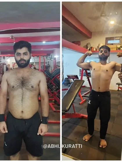 This is what happens when you trade excuses for discipline. Anurag went from a high-stress IT job, bad eating habits, and a health scare with triglycerides at 520, to losing 10 kgs in 5 months. He fought through a fatty liver diagnosis and learned to stay consistent even while traveling.