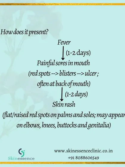 The disease typically presents with a fever for 1-2 days, followed by painful sores in the mouth, and then a skin rash on the hands and feet. Understanding this progression can help in early recognition.