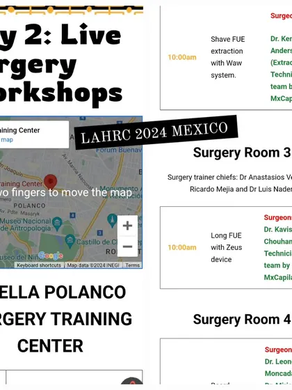 My session at LAHRC Mexico 2024 was dedicated to demonstrating Long Hair FUE with the Zeus device, a highly sought-after advanced skill.