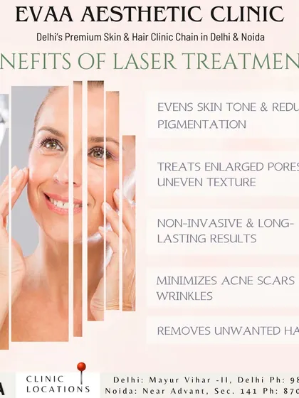This graphic summarizes the broad benefits of laser treatments, including evening skin tone, treating enlarged pores, minimizing acne scars, and removing unwanted hair.