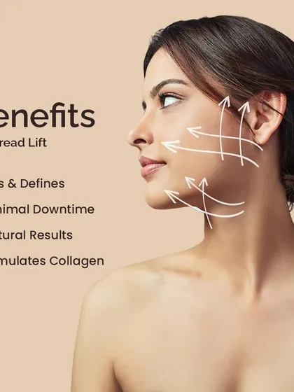 This graphic summarizes the benefits of a thread lift. It lifts and defines facial contours, requires minimal downtime, produces natural results, and stimulates your own collagen.