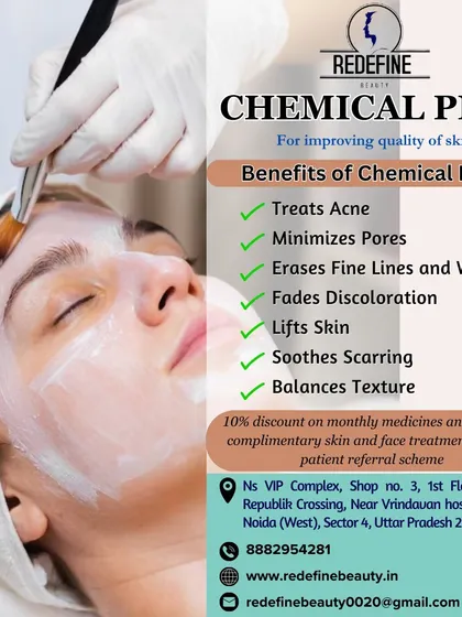 A chemical peel can address multiple skin concerns at once. It is effective for treating acne, minimizing pores, fading discoloration, and balancing overall skin texture for a rejuvenated look.