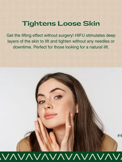 HIFU is an excellent option for tightening loose or sagging skin. The treatment provides a lifting effect without surgery by stimulating deep layers of the skin to firm up the facial contours.