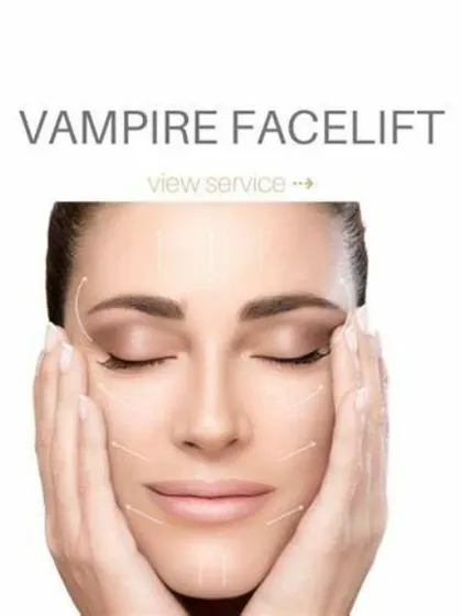 The Vampire Facelift is designed to lift and contour the face naturally. The white lines in this illustration show the strategic areas where PRP can be used to stimulate collagen and provide a subtle, rejuvenating lift.