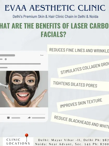 This infographic details the benefits of our Laser Carbon Facials, which include reducing fine lines, stimulating collagen growth, tightening pores, and improving overall skin texture.