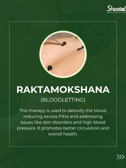 Raktamokshana is a traditional blood purification therapy, often performed using medicinal leeches as seen here. This process detoxifies the blood by removing impurities, which is particularly effective for stubborn skin disorders, reducing excess Pitta, and improving circulation.