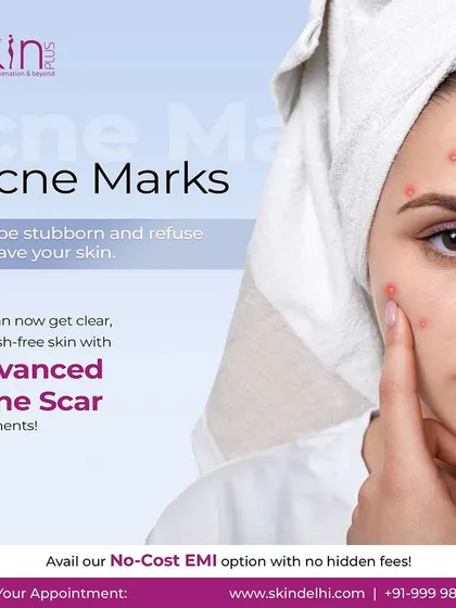 This graphic explains that my advanced acne scar treatments can provide clear, blemish-free skin for those struggling with stubborn marks.