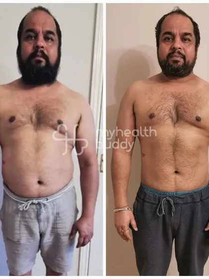 Vikas lost 8 kgs in 3 months and improved his type 2 diabetes management by correcting the flaws in his "healthy" diet.