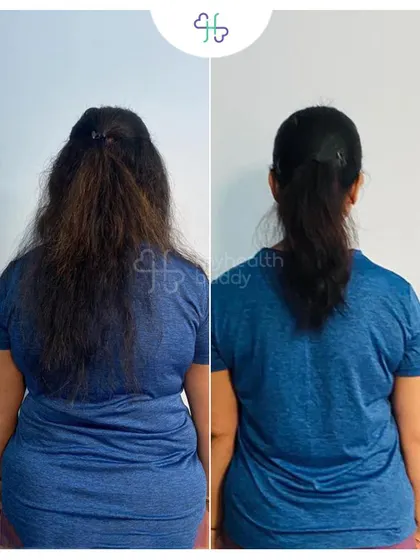 Rashmi lost an incredible 15 kgs in just 12 weeks. This back view shows the significant change in her body composition.