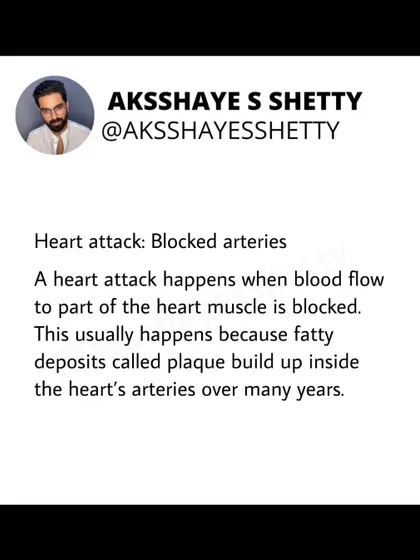 A heart attack happens when blood flow to the heart muscle is blocked. This is usually due to fatty deposits called plaque building up in the heart's arteries over many years.