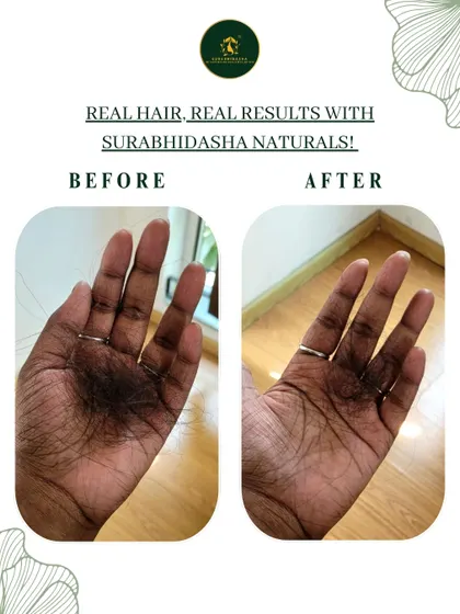 This is why I started Surabhidasha. This image shows the real, visible reduction in hair fall a client experienced after using my Protein Shampoo and Hibiscus Glow Conditioner. It’s not about magic, it’s about giving your hair the right natural nourishment.
