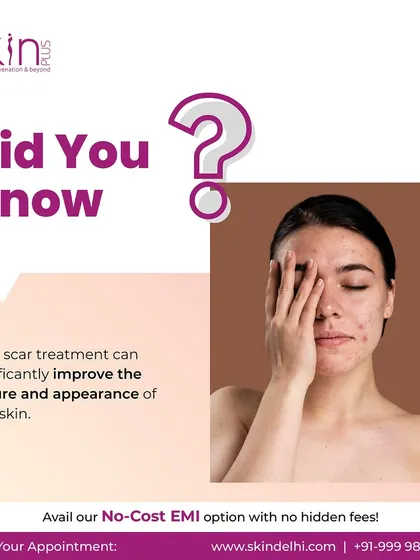 Did you know that acne scar treatments can significantly improve your skin's texture and appearance? We offer advanced options like laser therapy, chemical peels, and microneedling to help you achieve a smoother complexion.