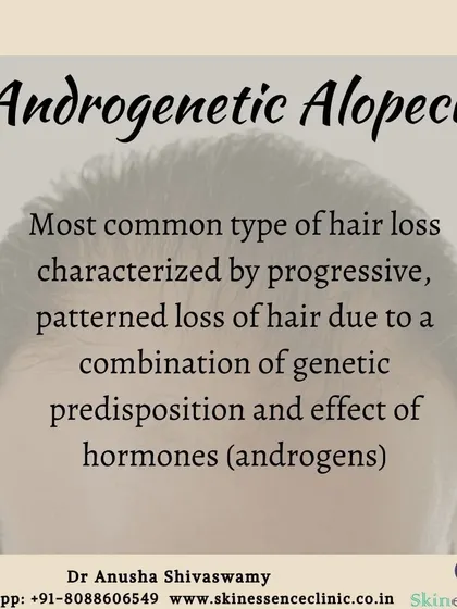 Androgenetic alopecia is the clinical term for male or female pattern hair loss. It is the most common type of hair loss I treat and is caused by a combination of genetic predisposition and the effect of hormones on hair follicles.