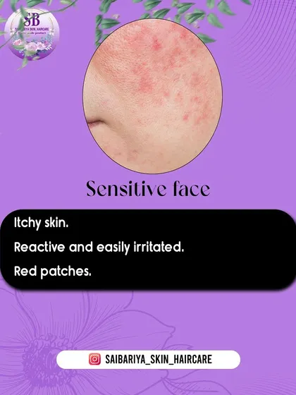 Do you have sensitive skin? It's often itchy, reactive, easily irritated, and can have red patches. It's important to use very gentle, natural products.