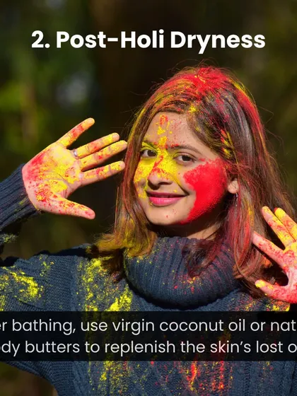 How to handle post-Holi dryness. After bathing, use virgin coconut oil or natural body butters to replenish the skin's lost oils.
