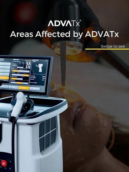 A look at the ADVATx machine and a client undergoing treatment. This device allows me to precisely target different layers of the skin to address the root cause of various concerns.