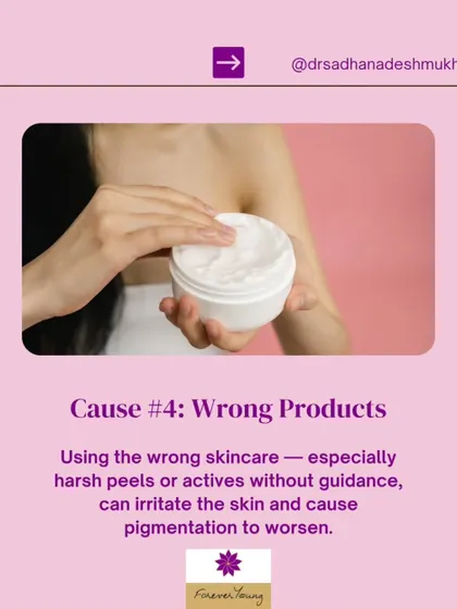 Using the wrong skincare products, especially harsh peels or actives without professional guidance, can irritate the skin and worsen pigmentation. It is essential to use products that are appropriate for your skin type and concerns to avoid causing further damage.