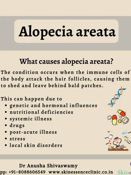 Understanding what triggers alopecia areata is important for management. This infographic lists potential causes, including genetic factors, stress, systemic illness, and nutritional deficiencies, which I evaluate during diagnosis.