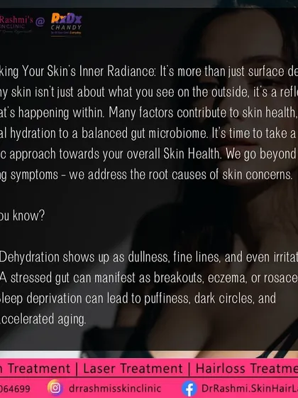 A deeper dive into holistic skin health. This graphic explains how internal factors like dehydration, a stressed gut, and sleep deprivation can manifest as dullness, breakouts, and accelerated aging. We must address the root cause.