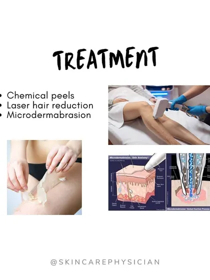 For persistent keratosis pilaris, I may recommend in-office treatments. Procedures like chemical peels, laser hair reduction, and microdermabrasion can help smooth the bumps and reduce associated redness.