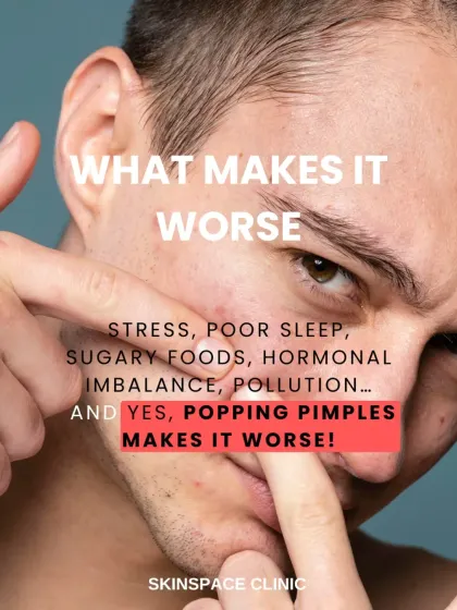 Many factors can make acne worse, including stress, poor sleep, diet, and hormonal imbalances. And yes, popping pimples always makes it worse by spreading bacteria and increasing the risk of scarring.