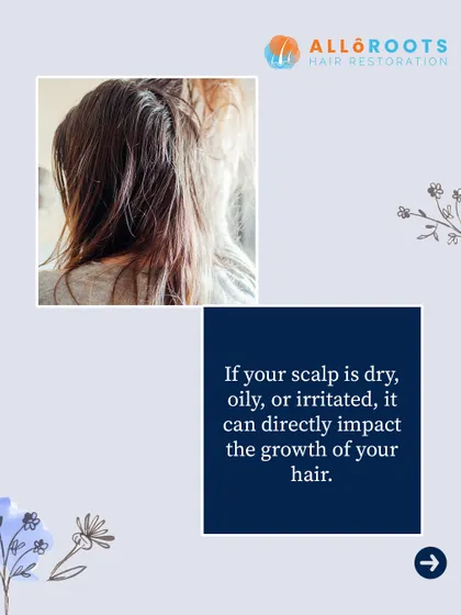 An imbalanced scalp, whether it's too dry, oily, or constantly irritated, directly impacts your hair's ability to grow. This unhealthy environment can weaken follicles and lead to thinning.