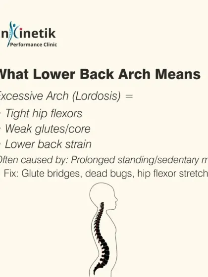An excessive lower back arch, or lordosis, often indicates tight hip flexors and weak glutes and core muscles. I recommend glute bridges, dead bugs, and hip flexor stretches to correct this postural issue.