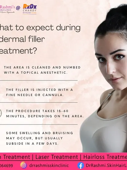 A step-by-step guide on what to expect during a dermal filler treatment, from numbing the area to the injection process and post-treatment care.
