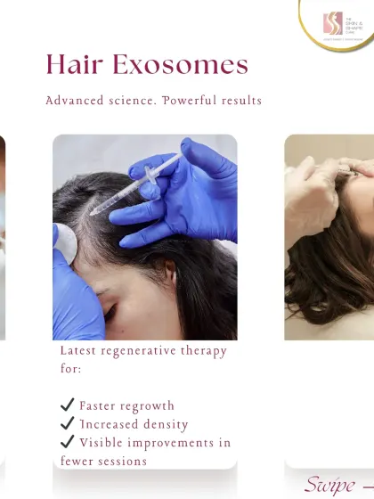 Hair Exosomes are a powerful regenerative therapy for faster regrowth and increased hair density. Many clients see visible improvements in fewer sessions compared to other treatments.