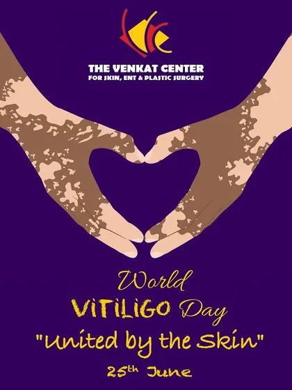 A graphic celebrating World Vitiligo Day with the message "United by the Skin," promoting acceptance and understanding.