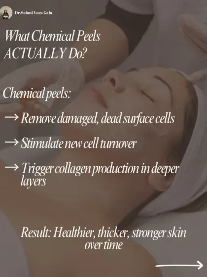This image shows what chemical peels actually do. They remove damaged surface cells, stimulate new cell turnover, and trigger collagen production in deeper layers. The result is healthier, thicker, and stronger skin.