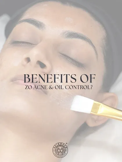The ZO Acne & Oil Control facial is a targeted treatment to manage breakouts. This image shows the application of a purifying mask to help regulate sebum and clear pores.
